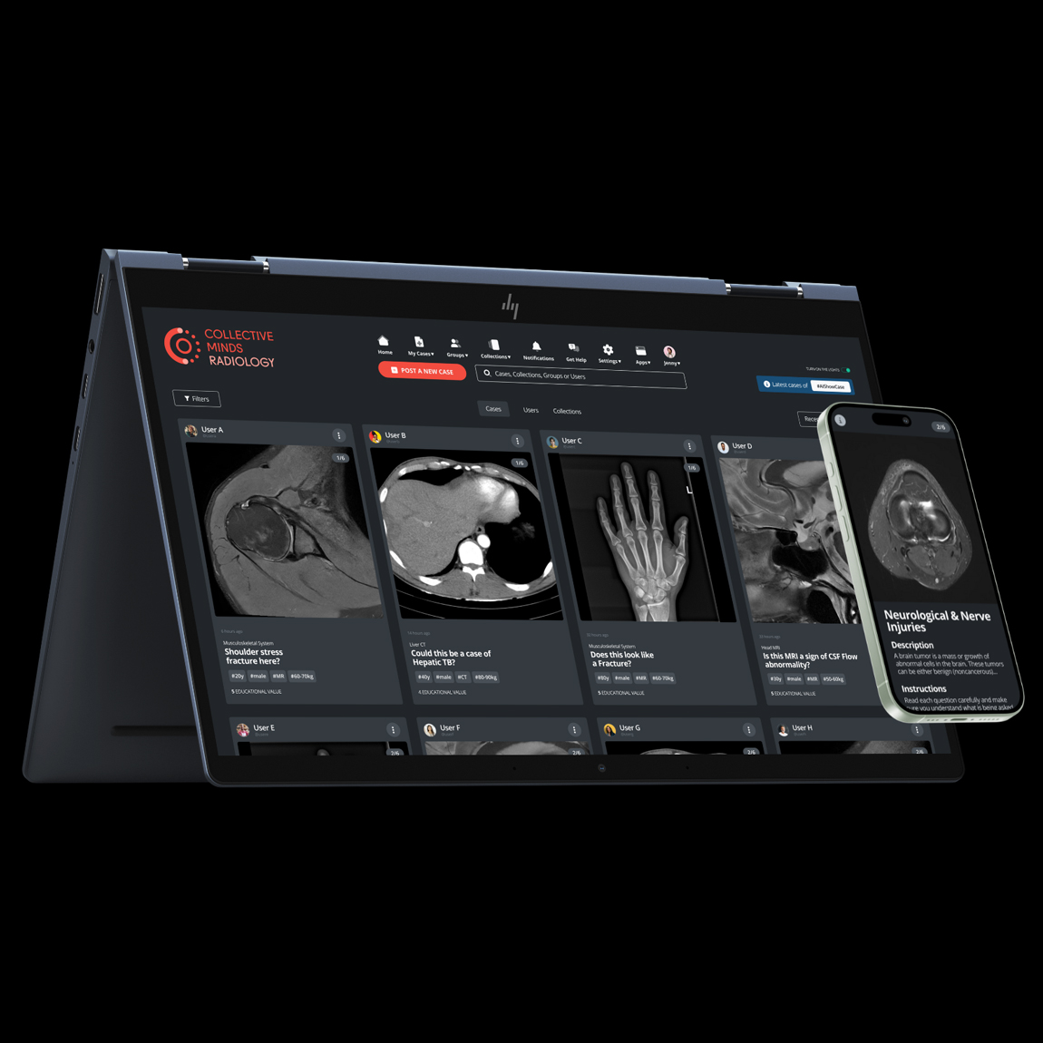 En bärbar dator i tältläge visar en radiologiplattform med flera medicinska bildfall, inklusive MRI- och CT-skanningar, upplagda av olika användare. Plattformen har en mörk design med "COLLECTIVE MINDS RADIOLOGY"-logotypen i det övre vänstra hörnet. Bredvid datorn syns en smartphone som visar ett fall om neurologiska och nervskador, vilket antyder att plattformen är tillgänglig både på dator och mobil.