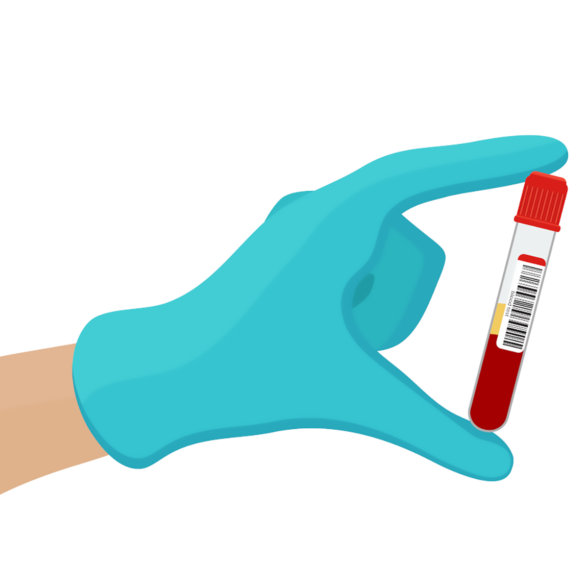 En hand med blå engångshandske håller ett provrör med blod. Provröret har röd kork och en etikett med streckkod. 