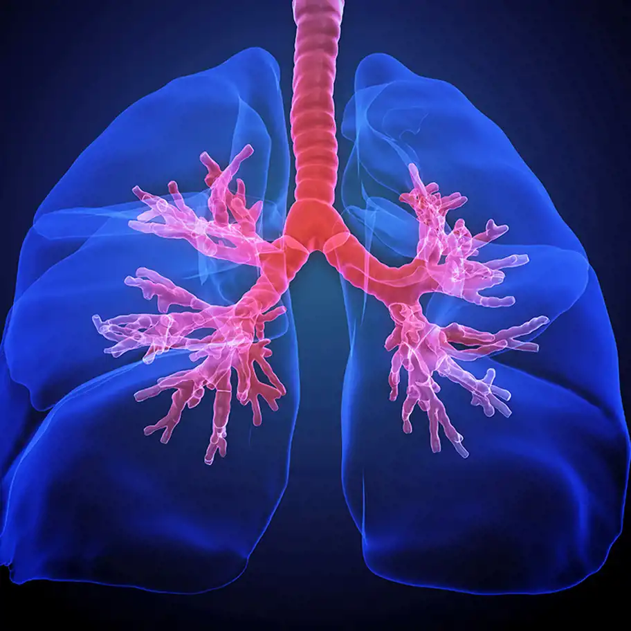 Röntgenbild på lungor.  
