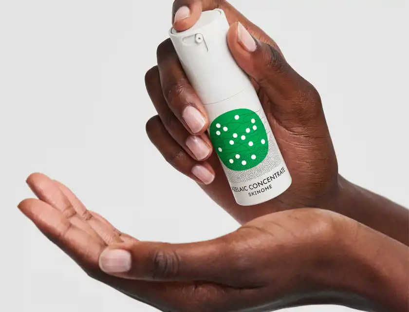 Två händer håller i en hudvårdsprodukt från Skinome med grön etikett, märkt 'Azelaic Concentrate', redo att appliceras på huden.