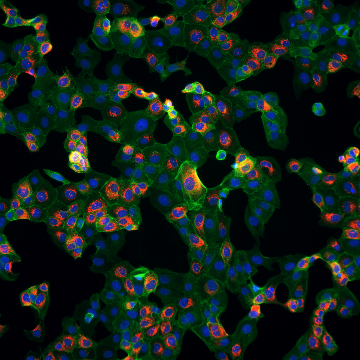 Bilden visar celler färgade med fluorescerande markörer: cellkärnorna är blå, cytoskelettet är grönt och vissa intracellulära strukturer lyser rött. Cellerna är utspridda i ett nätverk och har olika former och storlekar.